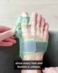 HalluxAlign™ Upgraded Bunion Corrector