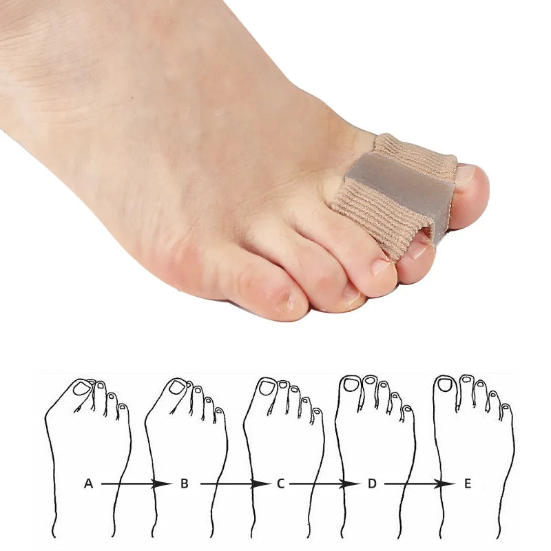 Gel Toe Spacers for Bunion and Hammer Toe Care
