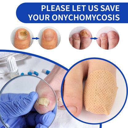 Fungal Nail Renewal Patches