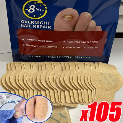 Fungal Nail Renewal Patches