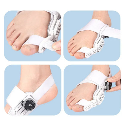 HalluxAlign™ Upgraded Bunion Corrector