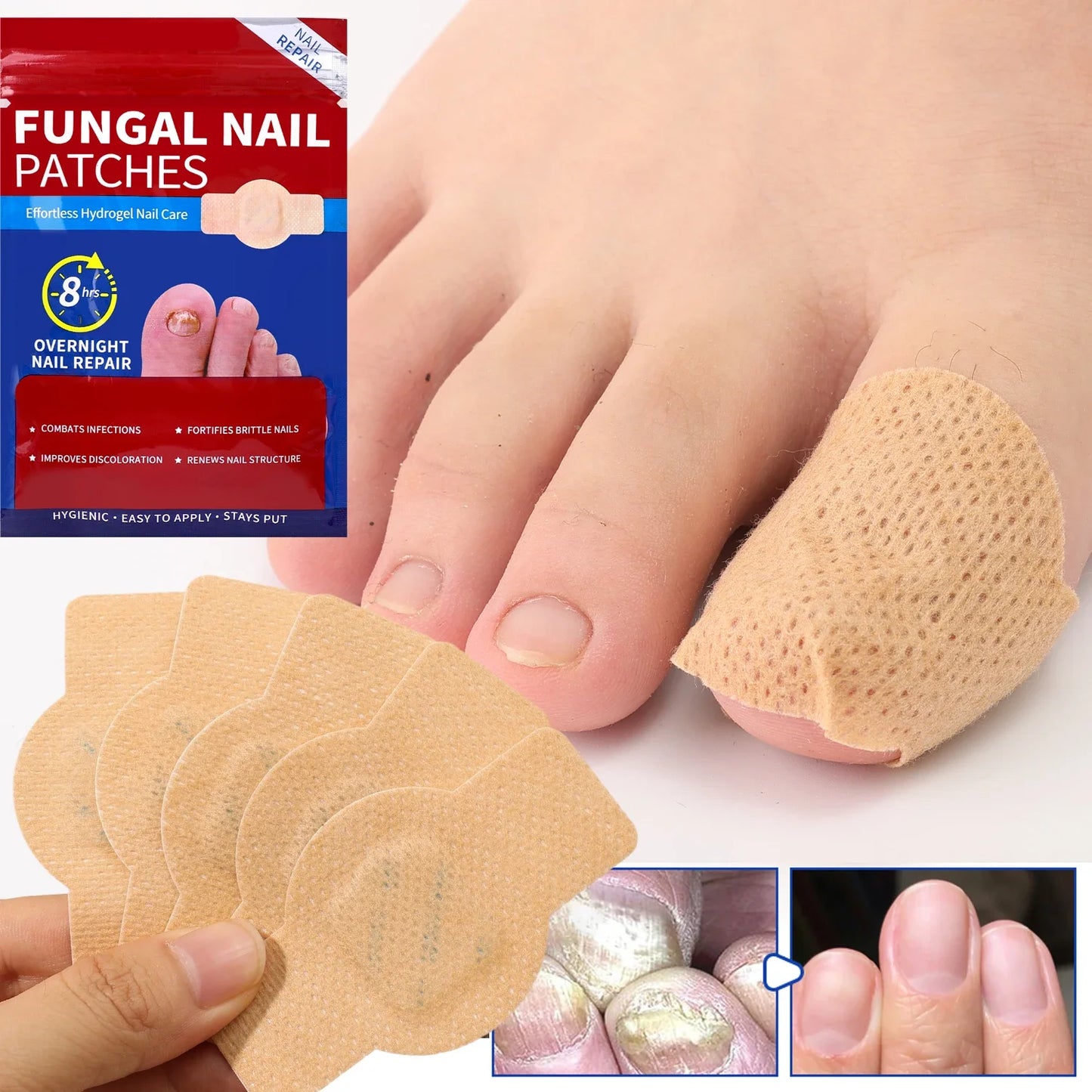 Fungal Nail Renewal Patches